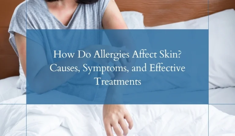 allergies-affect-skin