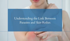 Parasites and Skin Rashes