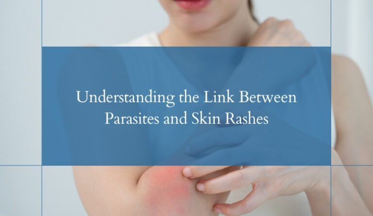Parasites and Skin Rashes