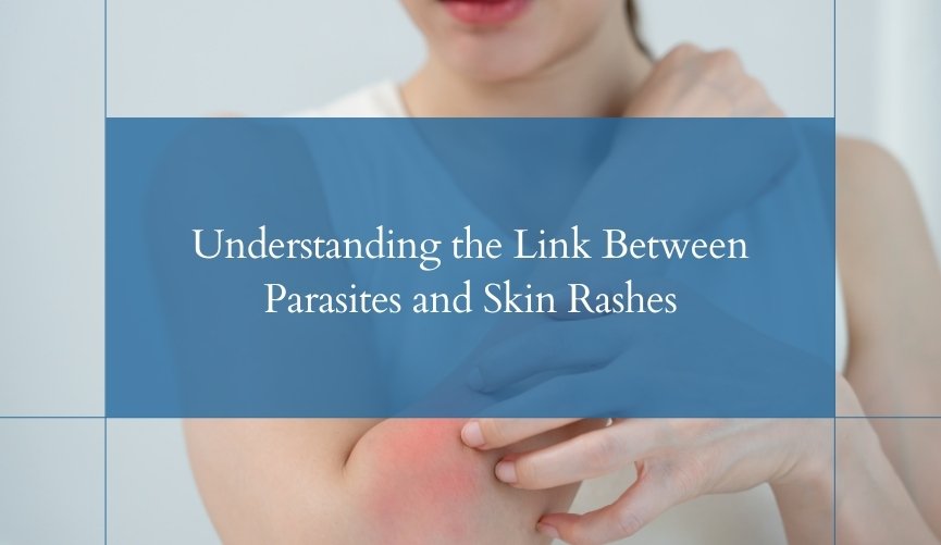 Understanding the Link Between Parasites and Skin Rashes