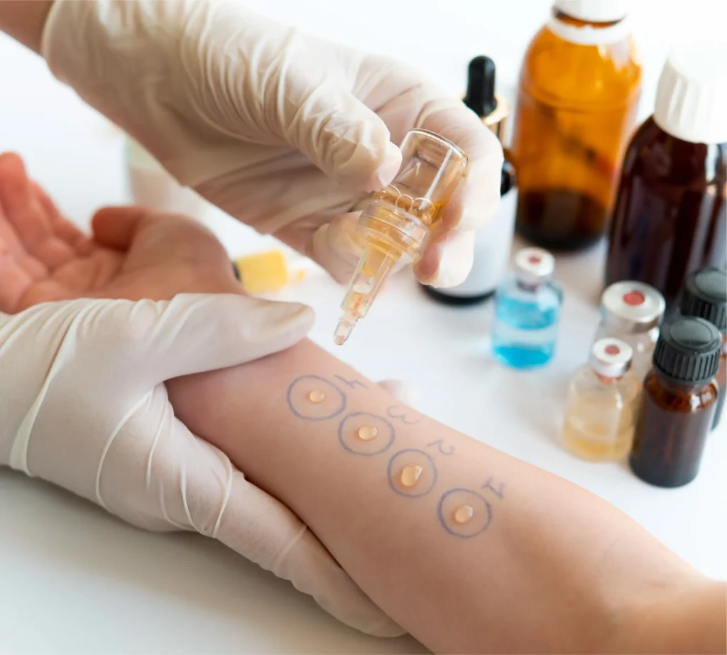 WeCareUrgentCare-Allergy Treatment-08