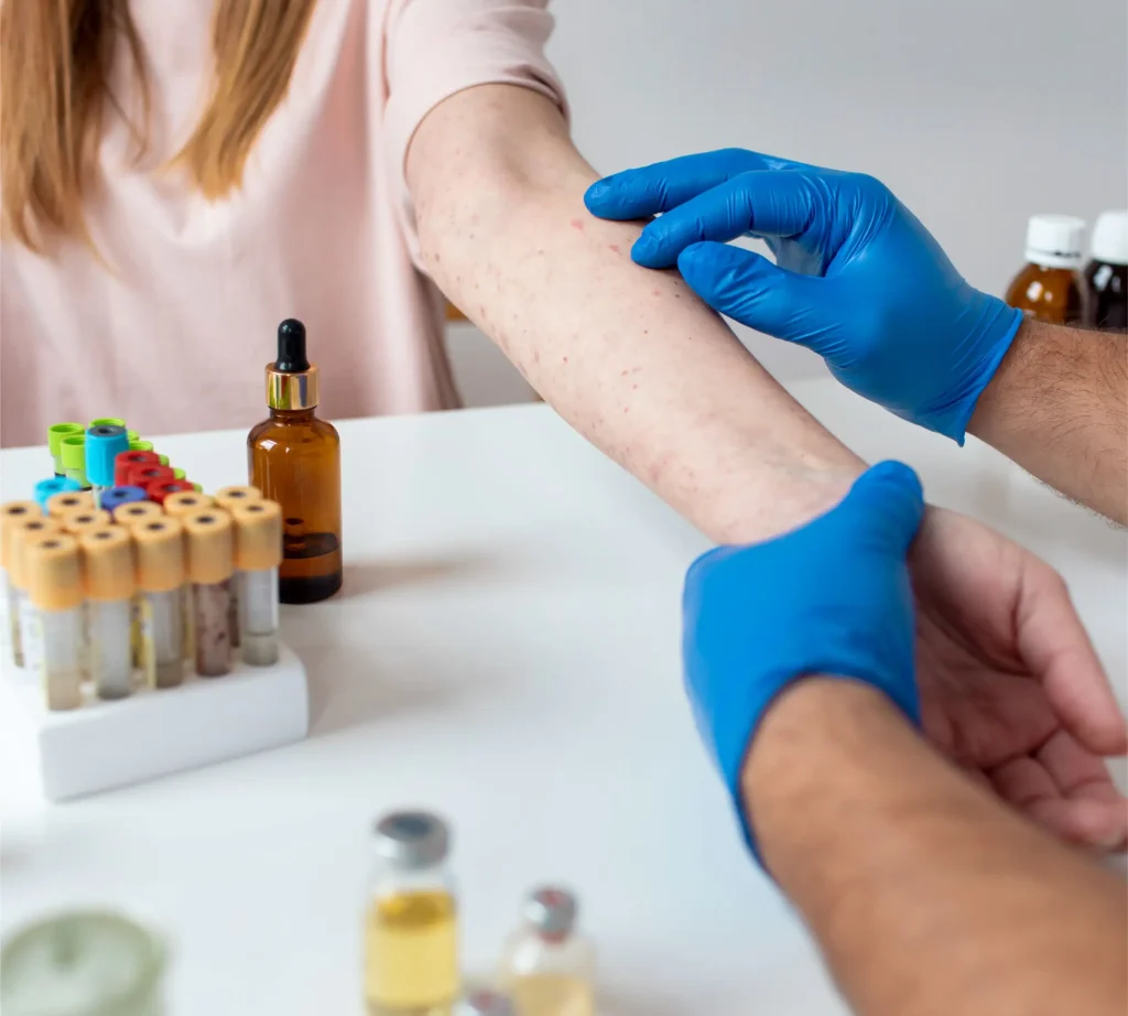 WeCareUrgentCare-Allergy Treatment-10