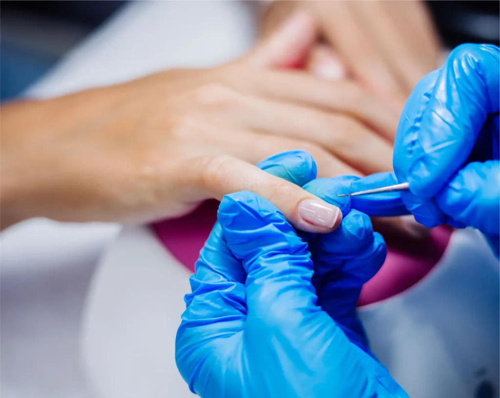 WeCareUrgentCare-Infected Tongnail-04