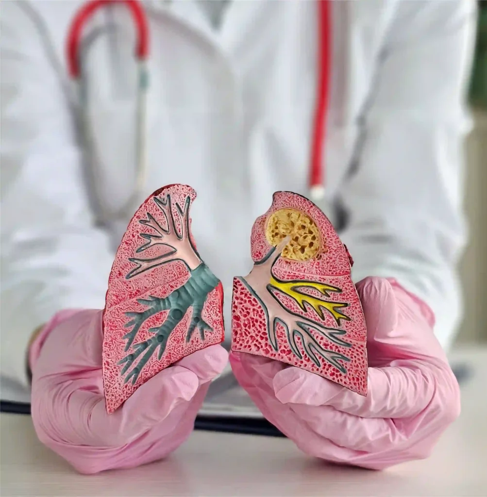 Fattah Primary Care-Pneumonia Treatment