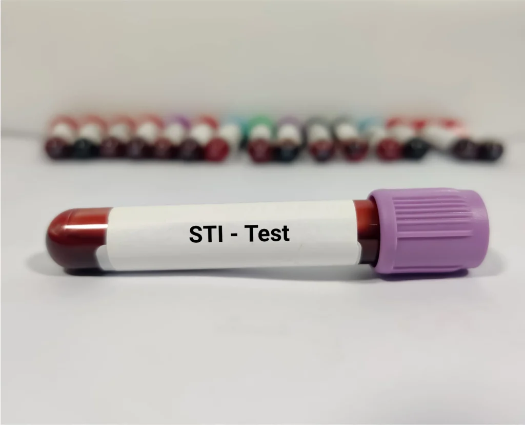 Fattah Primary Care-STD STI Testing-02
