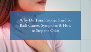 Why Do Tonsil Stones Smell So Bad_ Causes, Symptoms & How to Stop the Odor