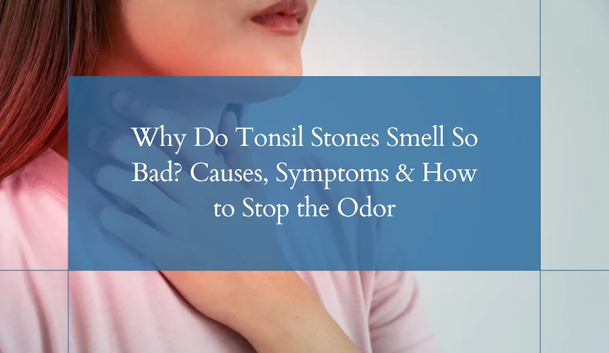 Why-Do-Tonsil-Stones