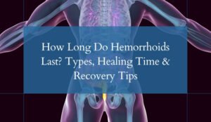 How Long Do Hemorrhoids Last Types, Healing Time & Recovery Tips