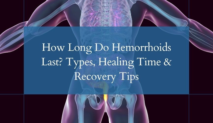 How Long Do Hemorrhoids Last Types, Healing Time & Recovery Tips