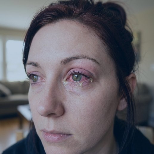 Are You Experiencing Pink Eye Symptoms