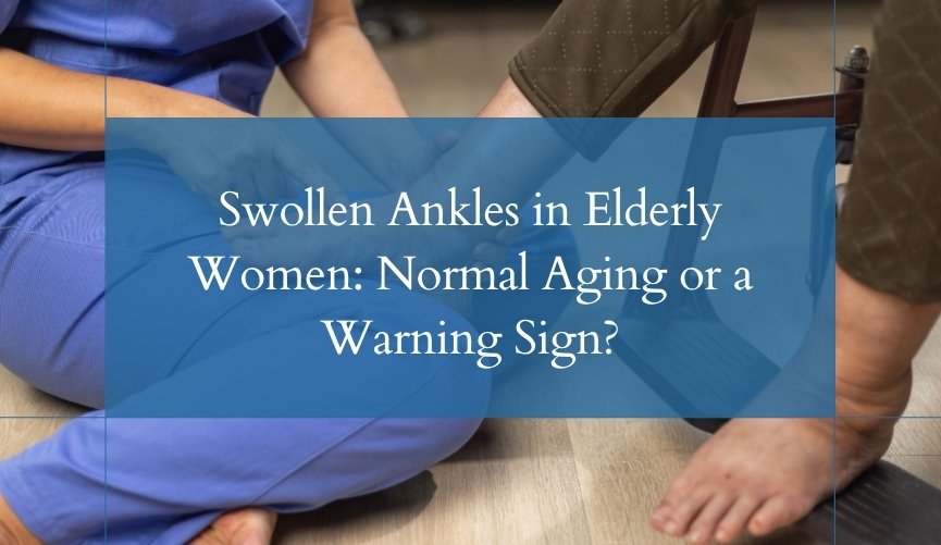 Swollen Ankles in Elderly Women Normal Aging or a Warning Sign